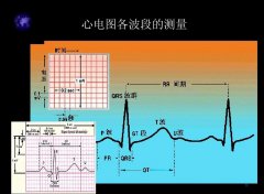 台湾某無限心電圖分析應用股权融资600万-800万元